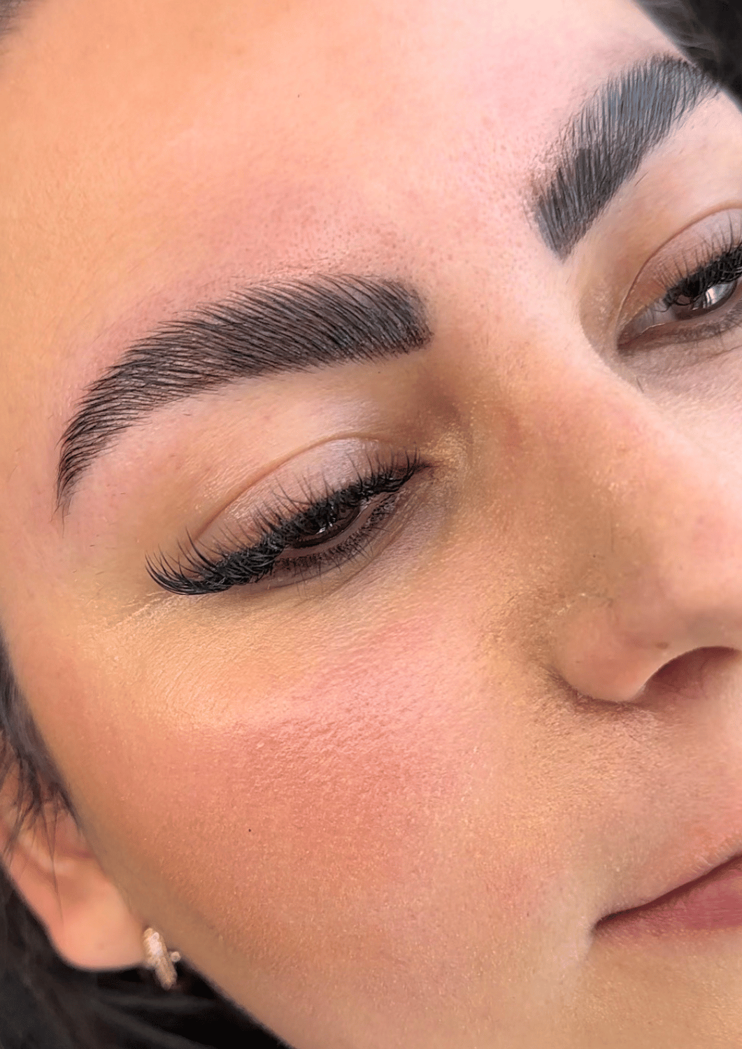 Browlift sourcils